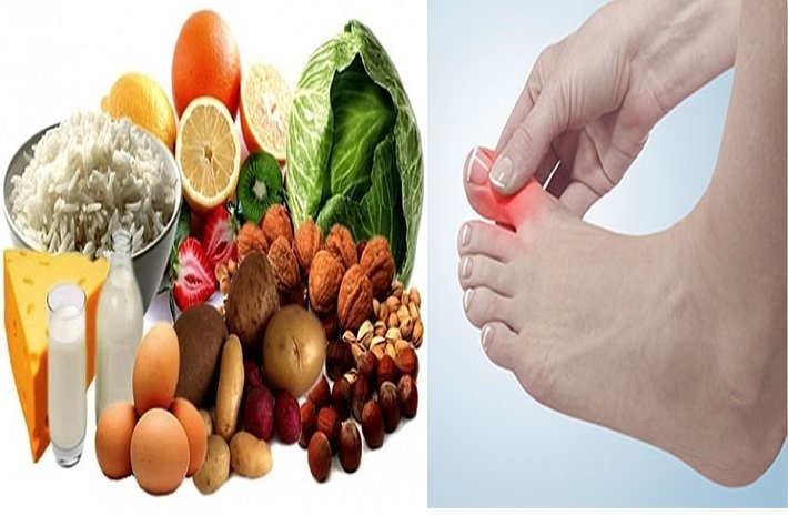 uric acid